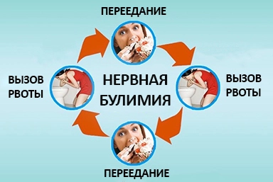 Лечение булимии в Клину